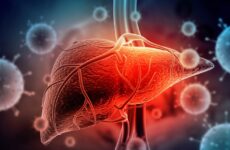 Hepatite virale B,C și D, măsurile de control și răspuns, anul 2022
